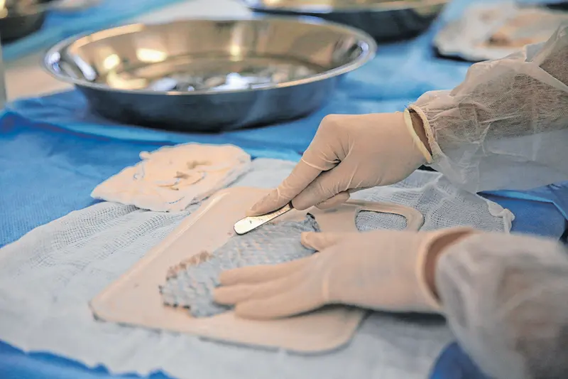Imagem da notícia: Tratamento de queimaduras com pele de tilápia pode ser expandido