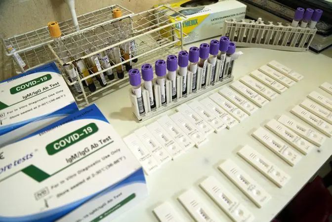 Imagem da notícia: Após determinação do STF, Ministério da Saúde volta a informar total de casos e óbitos de Covid-19