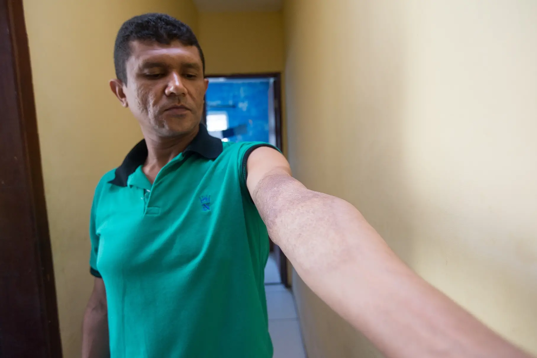 Imagem da notícia: Tratamentos com uso de pele da tilápia aceleram curas e abrem novas possibilidades na área da saúde