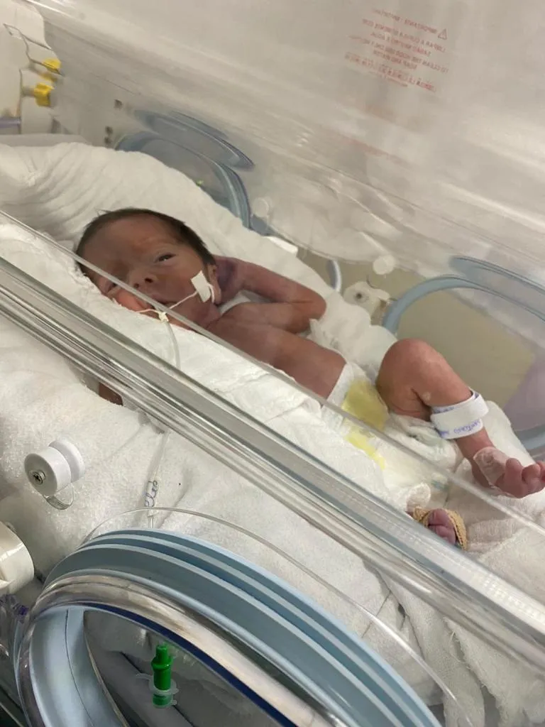 Lorenzo precisou ser reanimado e passou os primeiros dias de vida na UTI Neonatal