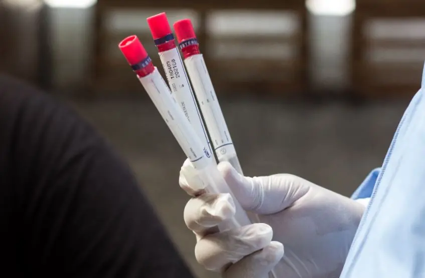 Imagem da notícia: Minas Gerais aplicará teste rápido de Covid-19 para identificar variantes do novo coronavírus