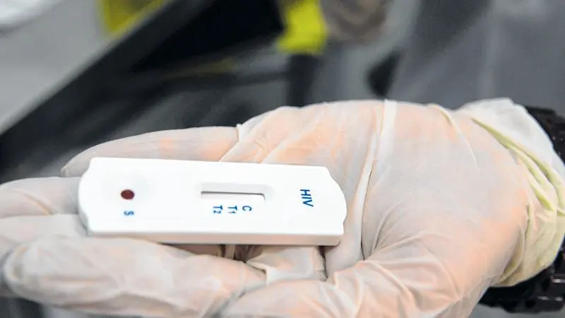 Imagem da notícia: Primeiro semestre de 2021 registra queda de 40% na notificação dos casos de HIV no Ceará