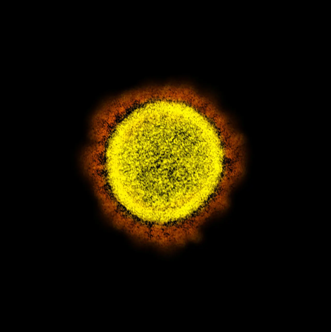 Imagem da notícia: Nova variante do coronavírus, Gama plus é identificada no Brasil