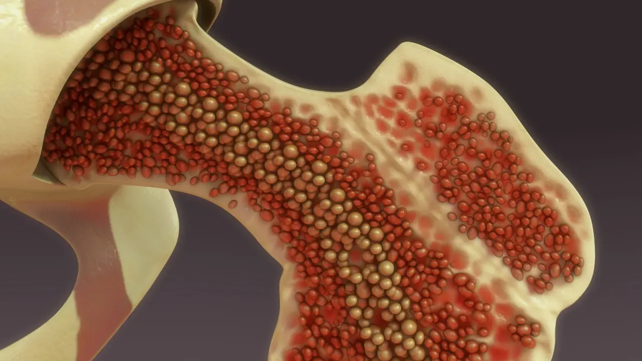 Medula óssea
