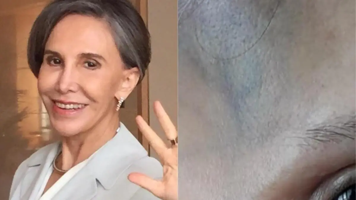 Imagem da notícia: 'Dona Florinda' de Chaves sofre acidente doméstico aos 72 anos