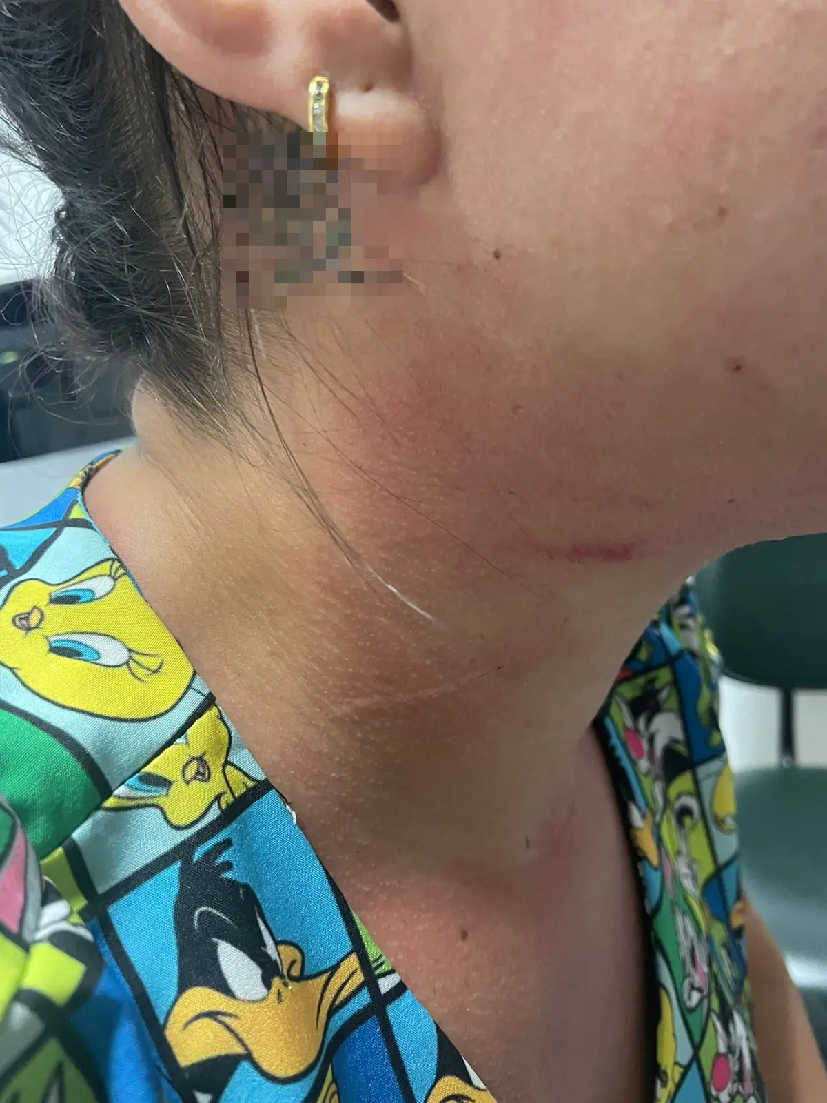 Imagem da notícia: Mãe de paciente agride enfermeira em hospital infantil em Fortaleza