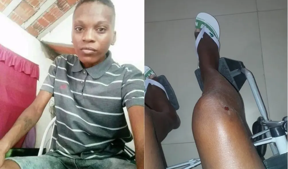 Imagem da notícia: Lésbica é agredida e tem joelho quebrado após usar banheiro feminino em Tauá, no Ceará