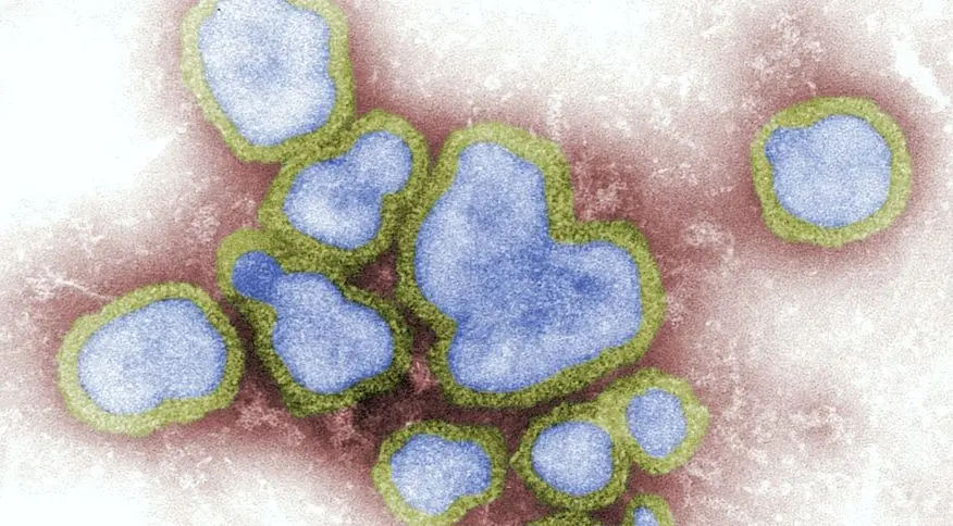 Imagem da notícia: Salvador registra segunda morte por Influenza H3N2