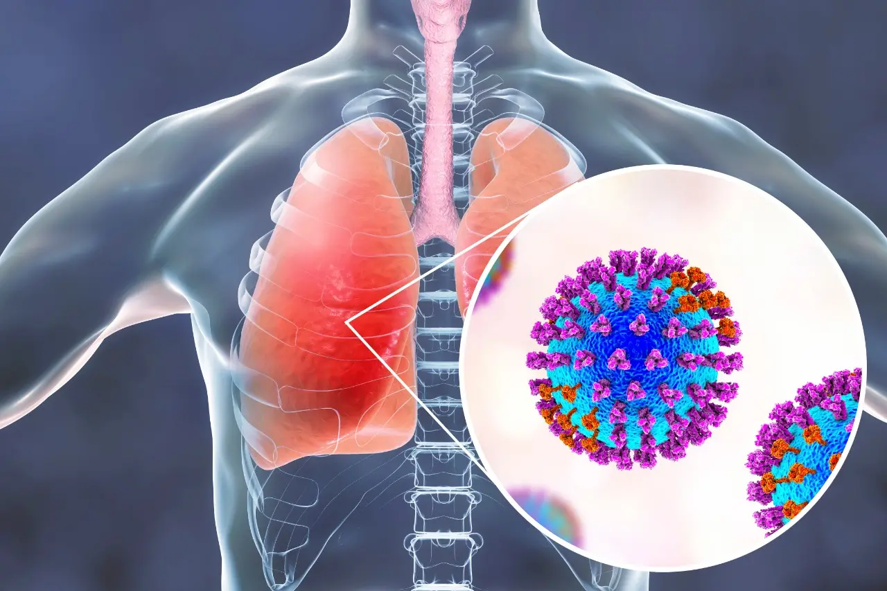 Imagem da notícia: Vírus Influenza H3N2: quais os sintomas e como se prevenir 