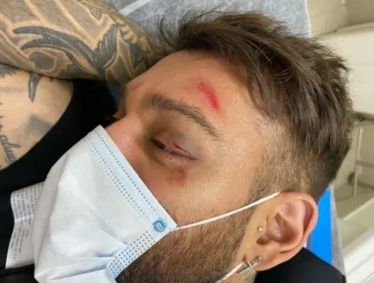 Imagem da notícia: Lucas Lucco quebra dedo ao cair de escada durante festa: 'é história para contar'