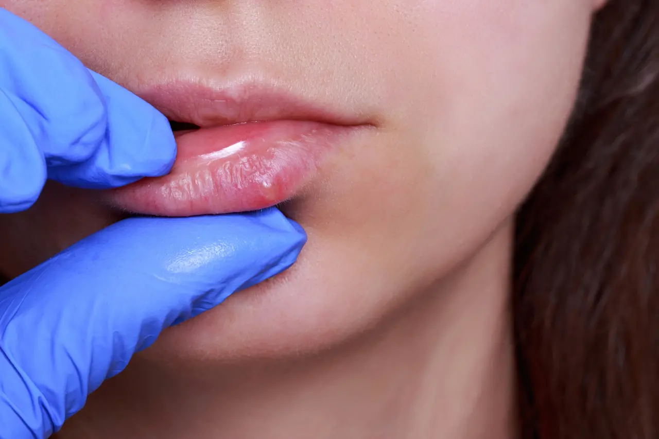 capa da noticia