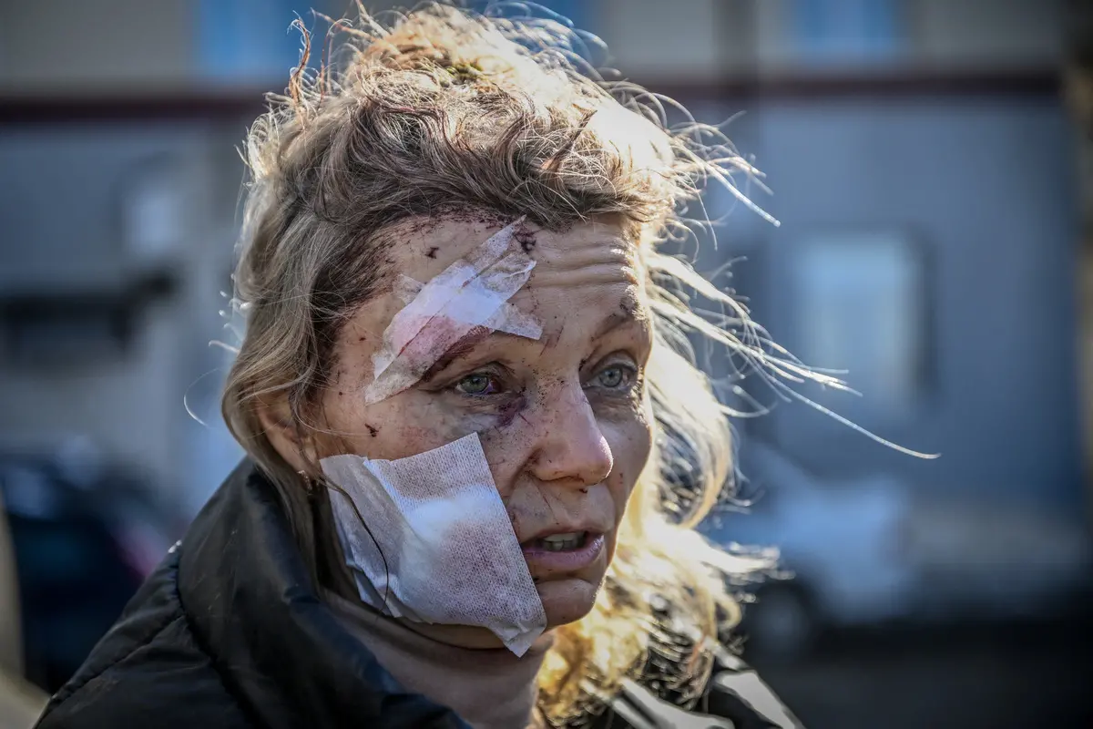 Imagem da notícia: Cenário de destruição: veja o conflito entre Rússia e Ucrânia em fotos