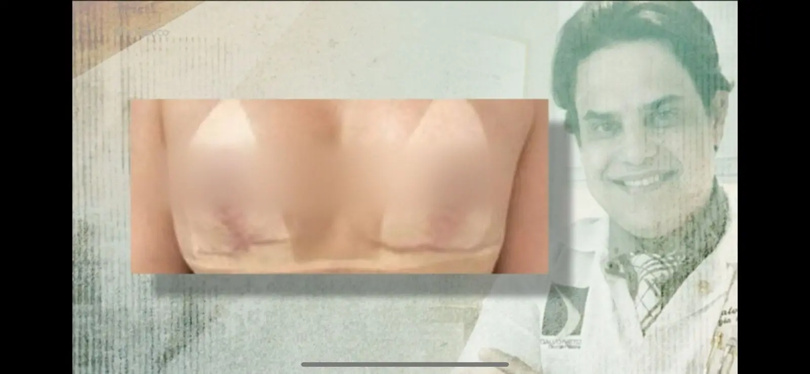 Imagem da notícia: Cirurgião plástico suspeito de erro médico no CE é réu na Justiça por tentar vender aparelho furtado