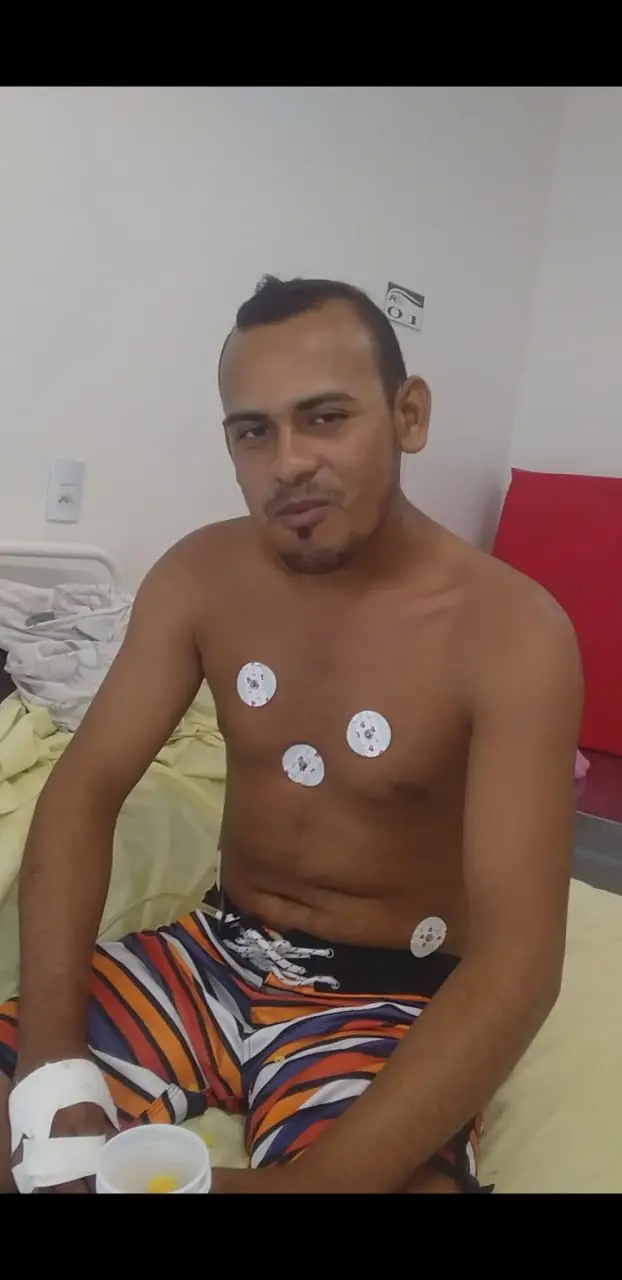 Imagem da notícia: Quem é e como está o pescador cearense atingido por peixe-leão, espécie venenosa encontrada no Ceará