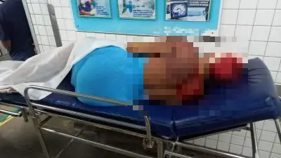 Imagem da notícia: Travesti é espancada por oito homens em motel na Barra do Ceará 