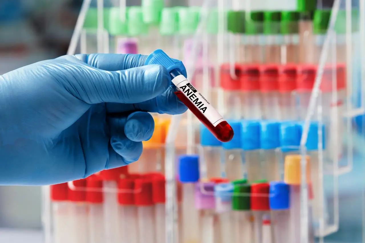 Imagem da notícia: Talassemia: conheça a doença e os sintomas mais comuns