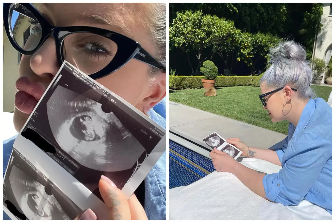 Imagem da notícia: Kelly Osbourne anuncia primeira gravidez: 'Em êxtase'