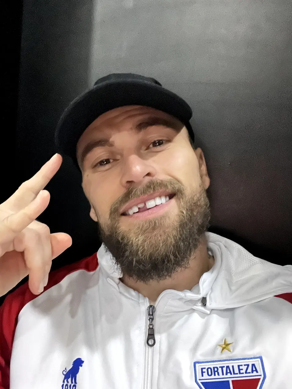 Imagem da notícia: Lucas Lima quebra dente durante partida Fortaleza e Colo Colo pela Libertadores