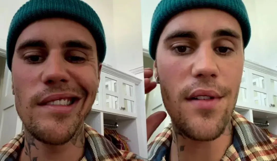 Imagem da notícia: Justin Bieber aparece com o rosto paralisado nas redes sociais
