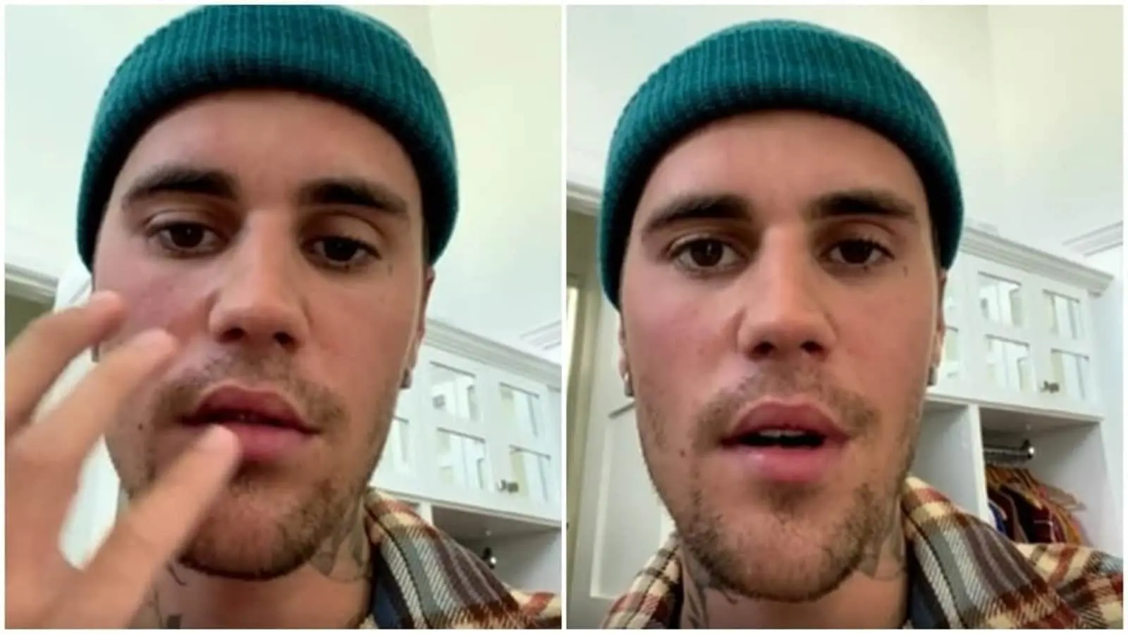 Imagem da notícia: Justin Bieber volta a falar sobre saúde após paralisia facial: 'cada dia melhor'