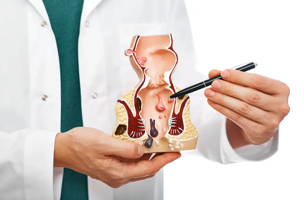 Médico explica doença hemorroidária