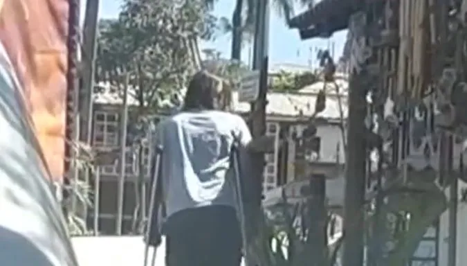 Dado Dolabella aparece com muletas nas imagens