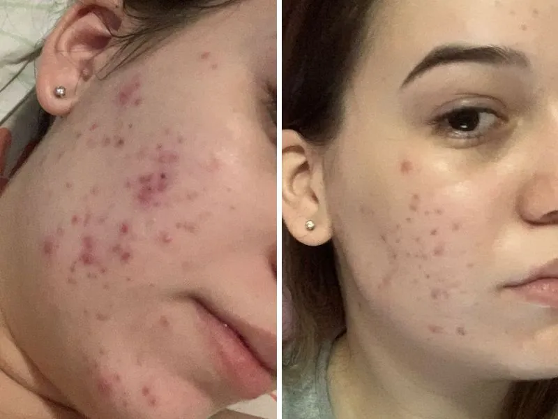 Um ano distancia as duas fotos. A primeira é de março de 2021 e a segunda é de março deste ano