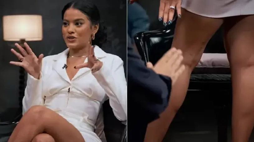 Imagem da notícia: Bella Campos, a Muda de 'Pantanal', revela ter sido mordida por jacaré durante banho de rio