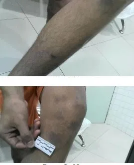 As cenas foram registradas e extraídas do circuito interno das unidades. Posteriormente, os exames constataram as agressões.