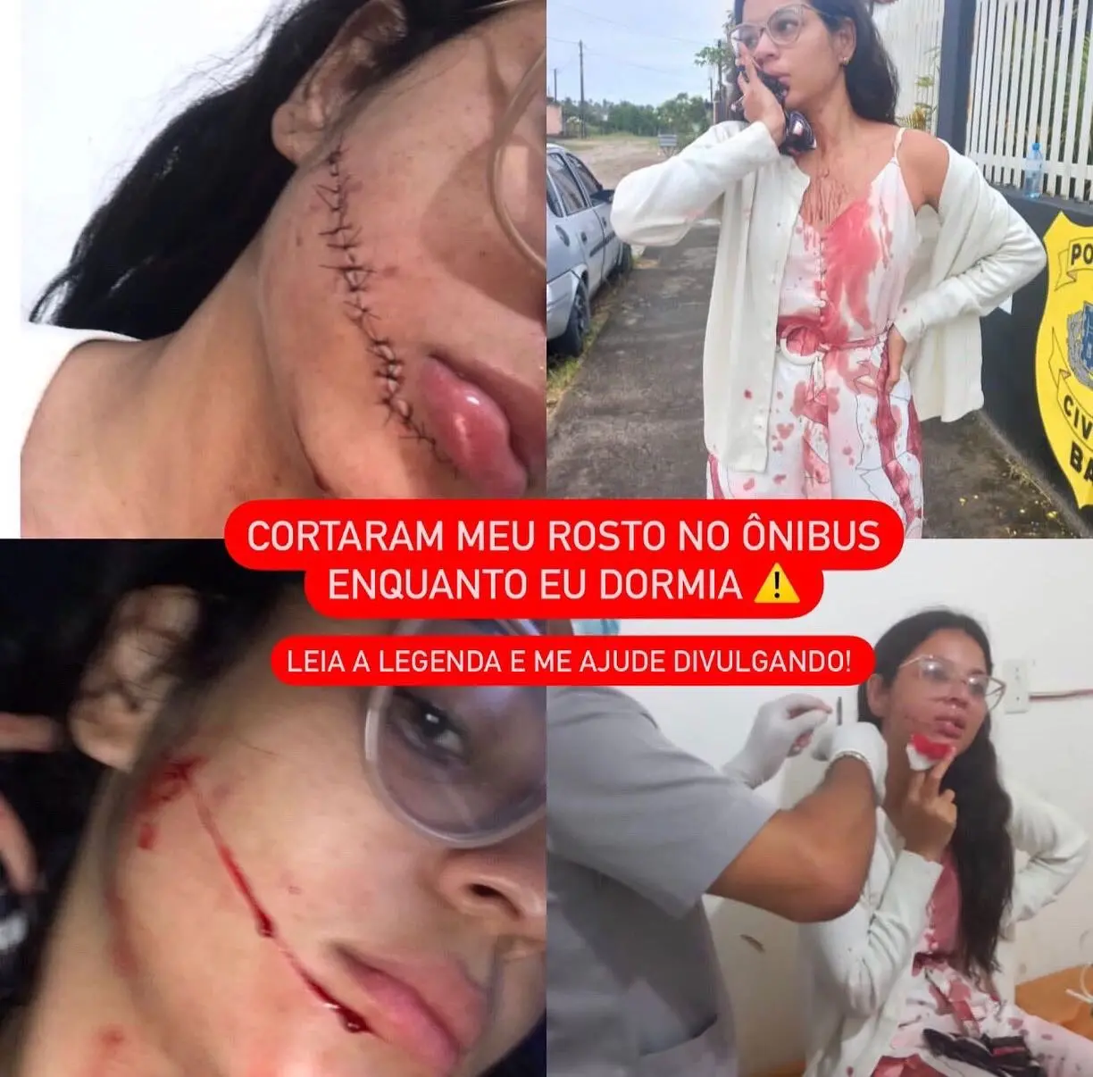 Imagem da notícia: Jovem tem rosto cortado em ônibus na Bahia