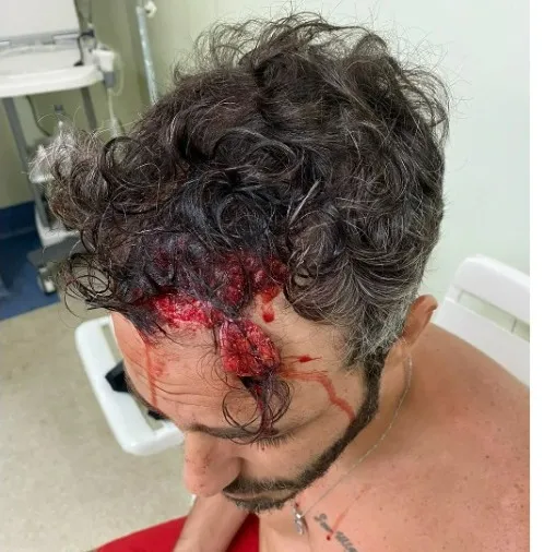 Imagem do ator sendo atendido na unidade hospitalar após agressão