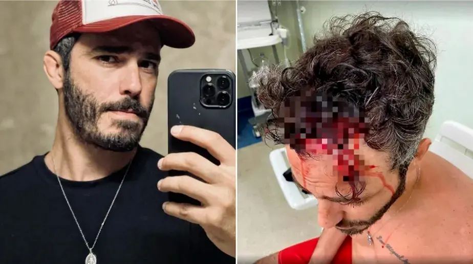 Imagem da notícia: Thiago Rodrigues ficou deitado por quase 30 minutos após queda, diz testemunha em depoimento 
