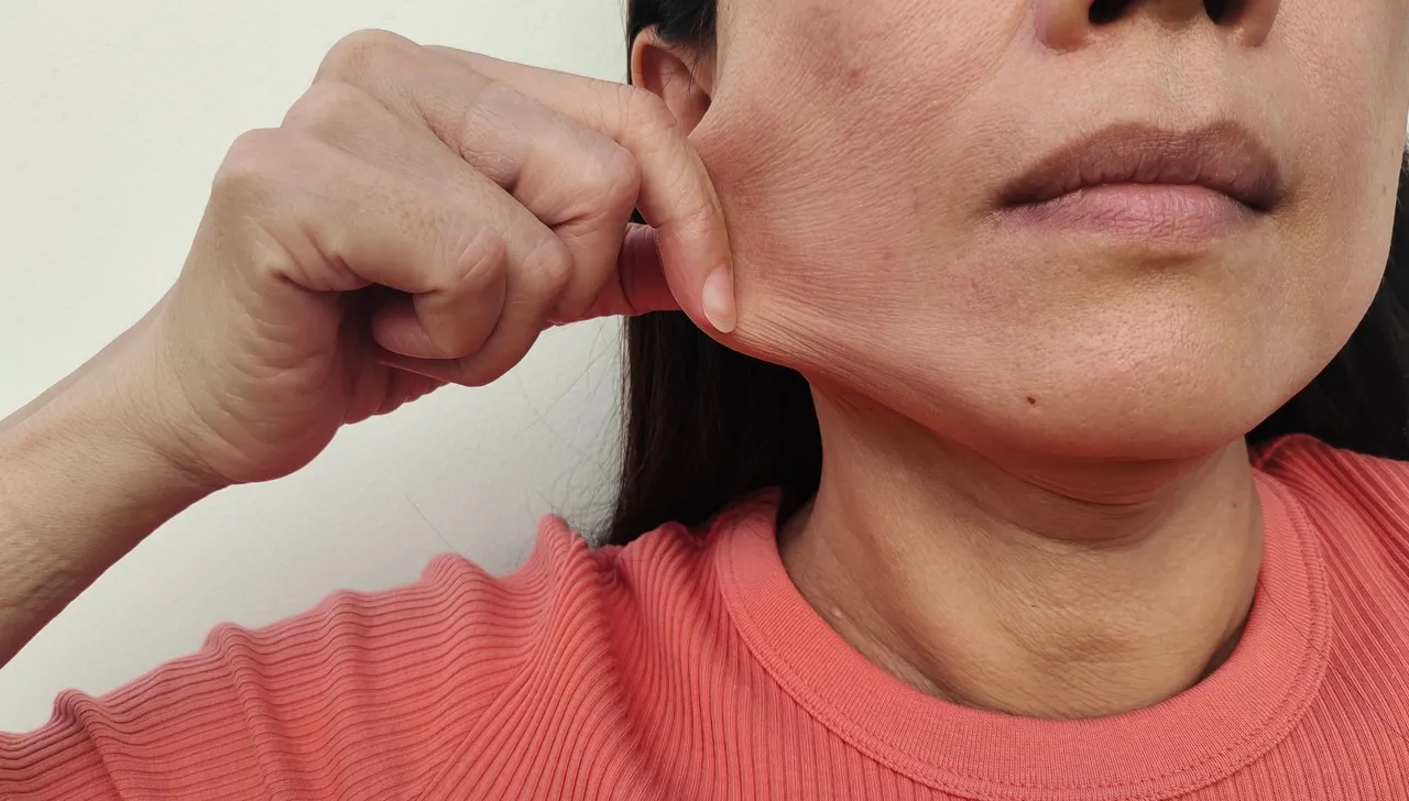 Um dos sinais da perda de colágeno é a flacidez da pele