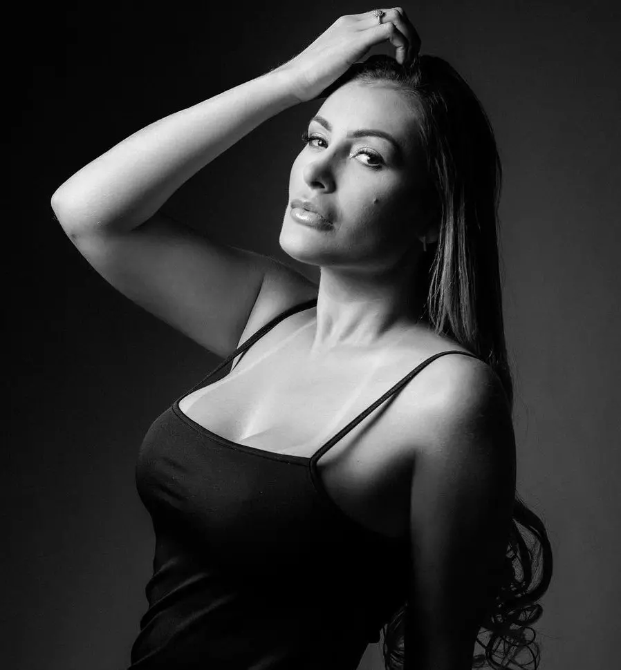 Imagem da notícia: Andressa Urach mostra como ficou a perna depois de problema com hidrogel