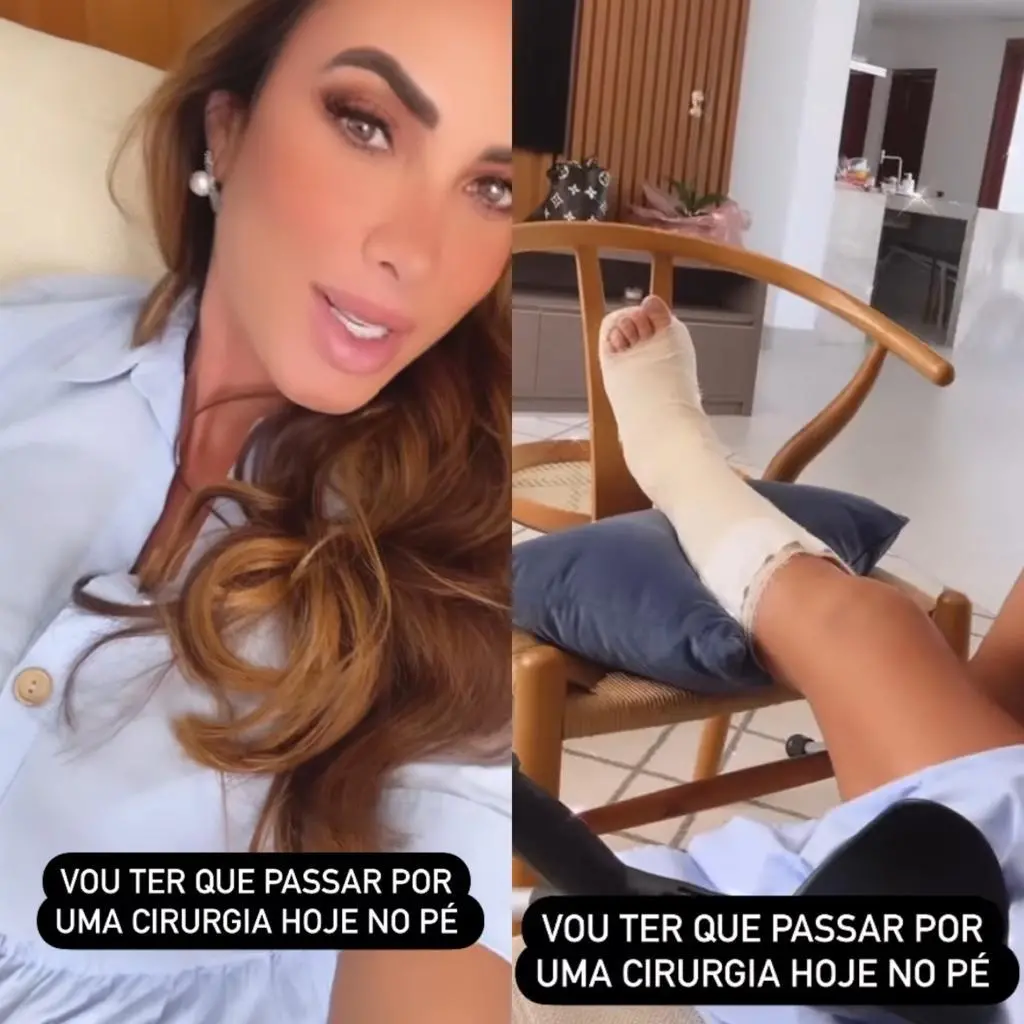 Imagem da notícia: Nicole Bahls faz cirurgia após quebrar o pé no Navio da Xuxa
