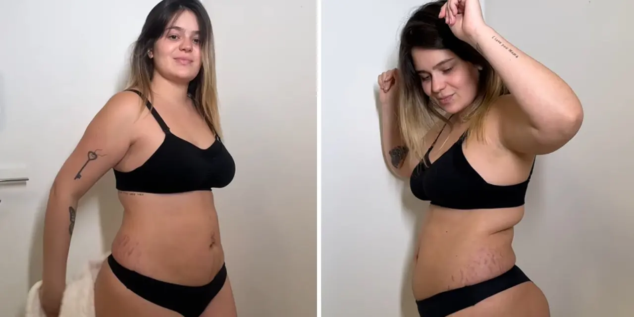 Imagem da notícia: Beleza materna: pressão estética distorce imagem corporal saudável