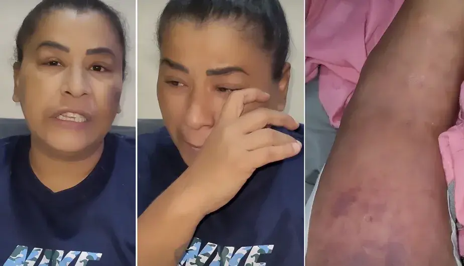 Imagem da notícia: MC Katia revela tumor no útero, problemas nos rins e pede ajuda aos fãs: 'não tenho outro recurso'