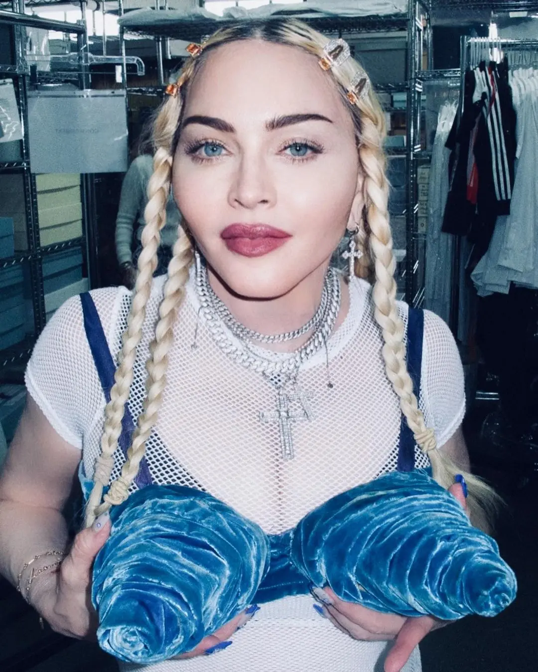 Imagem da notícia: Amigos dizem que estado de saúde de Madonna ainda inspira cuidados: ‘meses para se recuperar’
