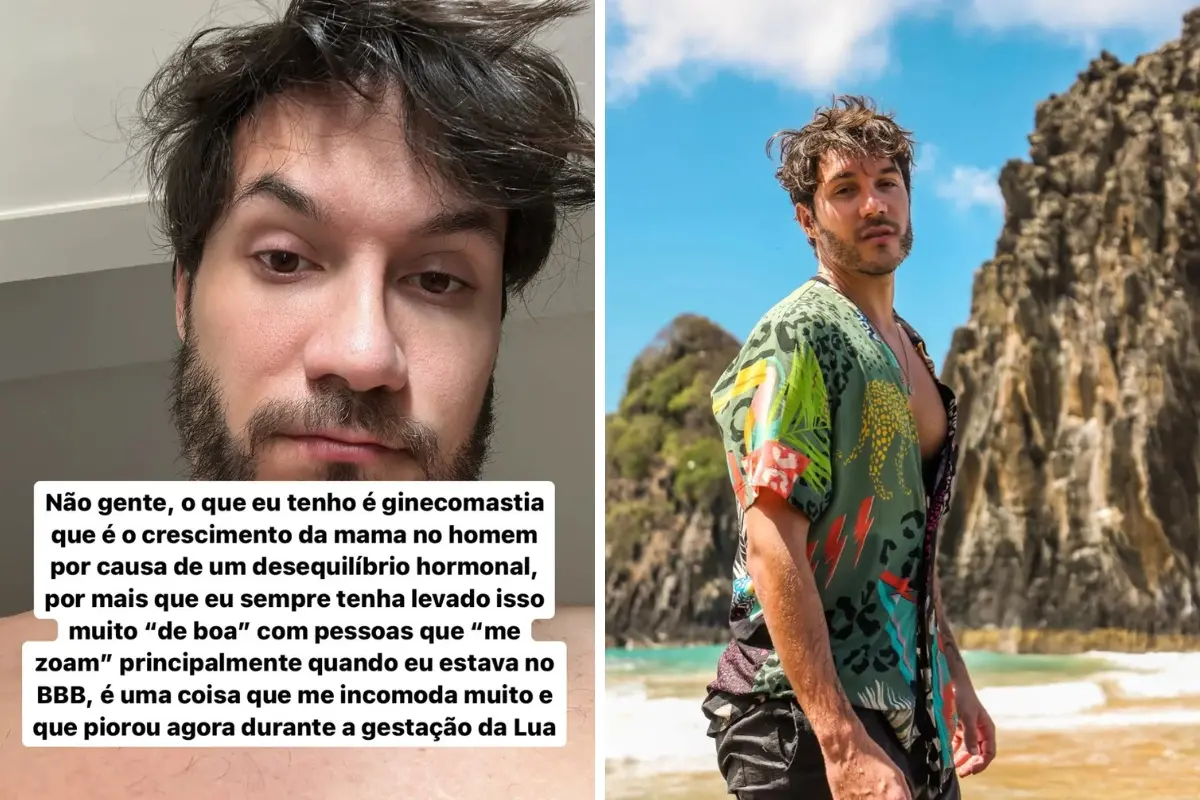 Imagem da notícia: Eliezer revela condição que resulta no crescimento das mamas; entenda o que é ginecomastia