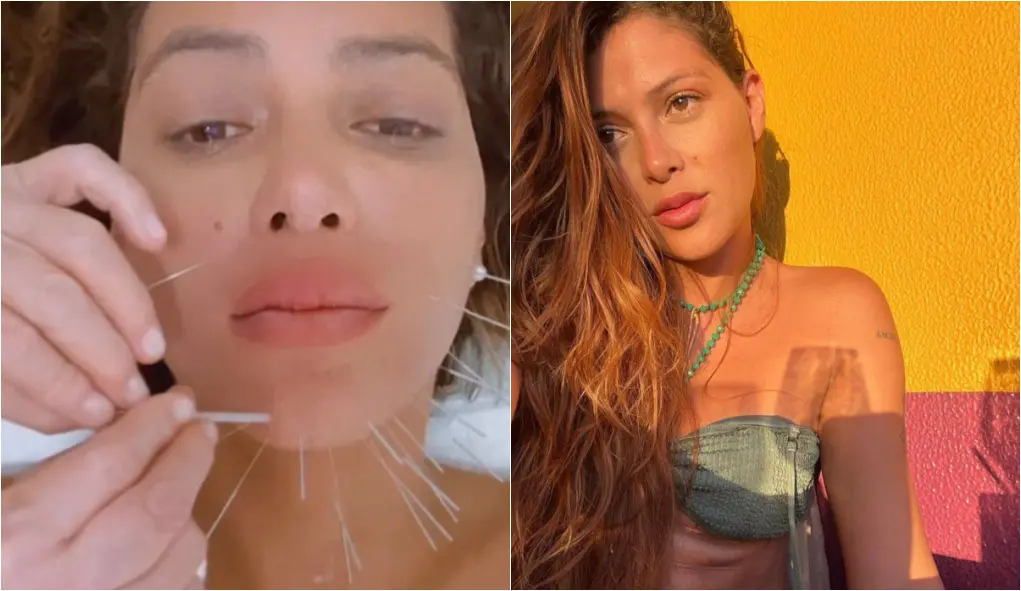 Imagem da notícia: Atriz Marcella Maia fica com rosto 'paralisado' por uso de silicone industrial