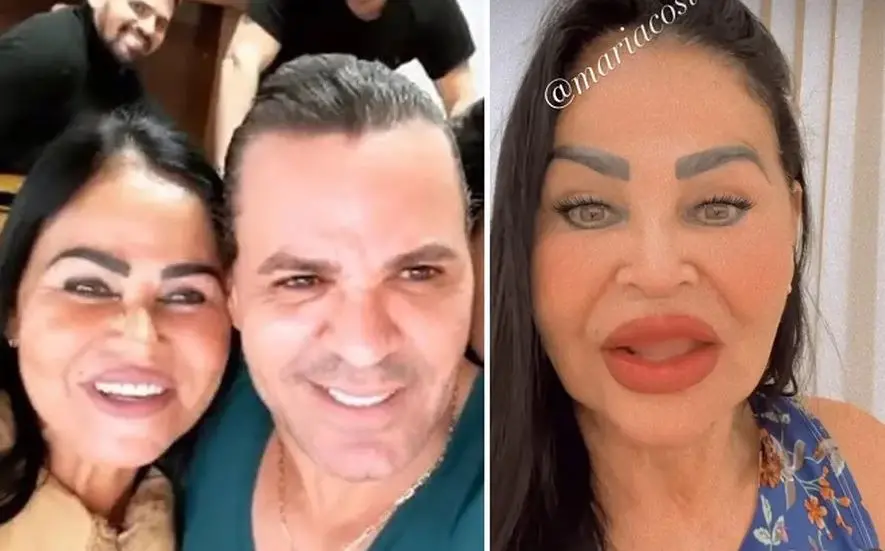 Imagem da notícia: Mãe de Eduardo Costa exibe resultado de harmonização facial e se lança como influencer