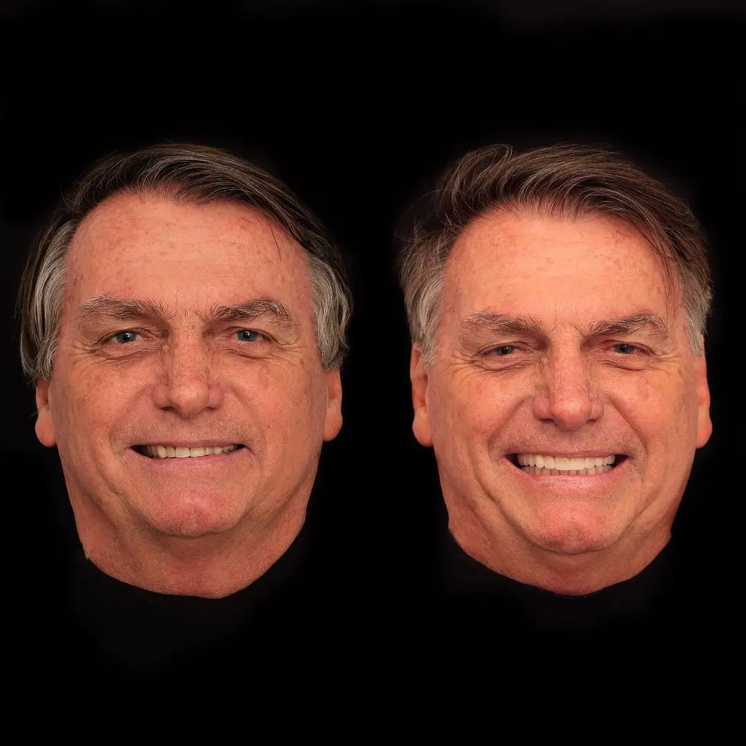 Imagem da notícia: Bolsonaro faz harmonização dentária em clínica de Goiânia; veja vídeo
