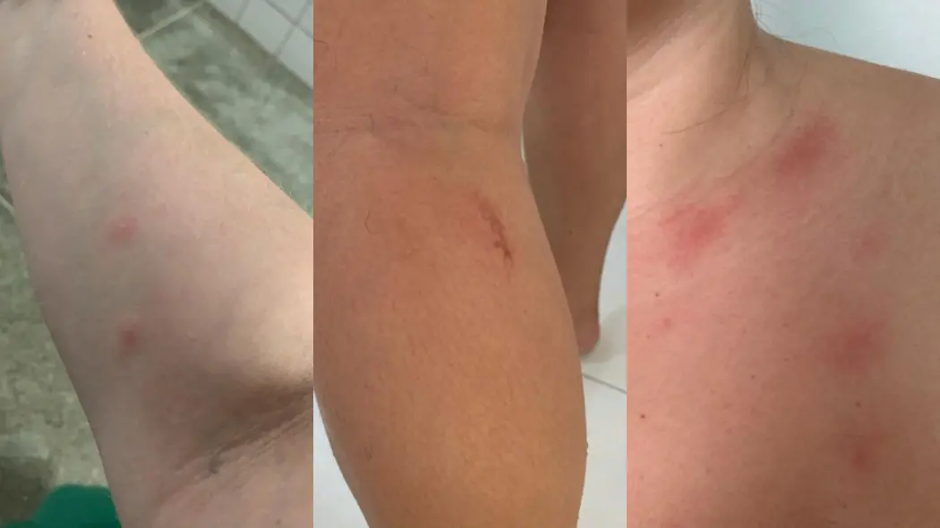 Imagem da notícia: Médicos denunciam infestação de pulgas e carrapatos na UPA do Canindezinho