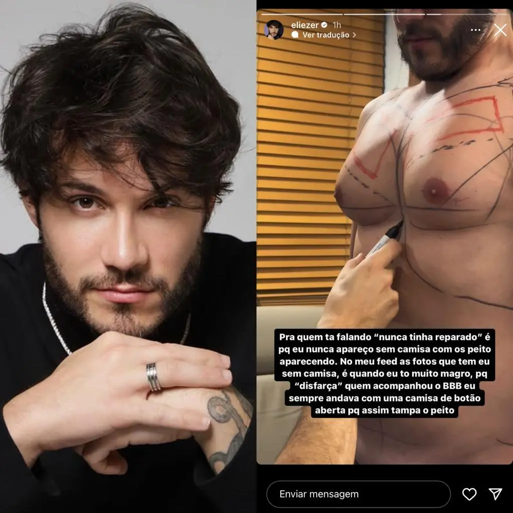 Imagem da notícia: Eliezer faz cirurgia para redução das mamas: 'deu tudo certo'