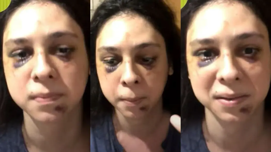 Imagem da notícia: Victor Meyniel diz ter acionado a polícia após ficar 4 minutos no chão: 'eu mesmo liguei'