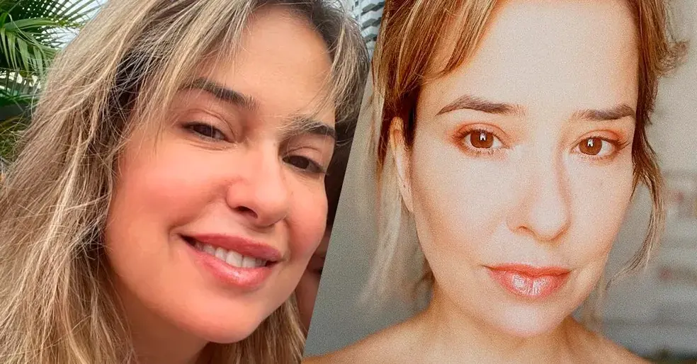 Imagem da notícia: Paloma Duarte explica inchaço no rosto e rebate críticas: 'não é da conta de ninguém'