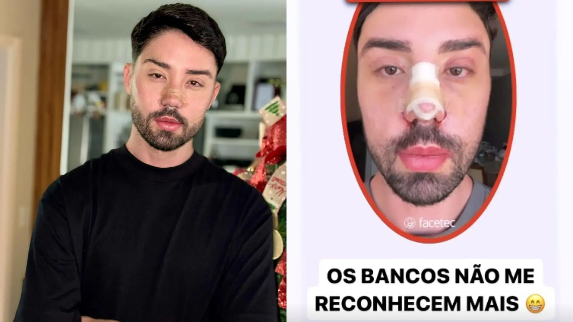 Imagem da notícia: Rico Melquíades diz que inteligência artificial não o reconhece após mudança estética no rosto