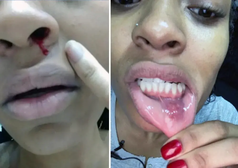 Imagem da notícia: Patrícia Ramos mostra ferimentos e diz que foi extorquida pelo ex-marido para que o divórcio saísse