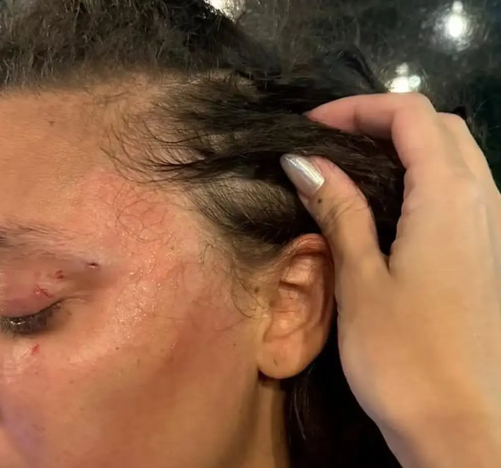 Imagem da notícia: Mulher é agredida em banheiro de restaurante em Recife: 'Você é homem ou mulher?'