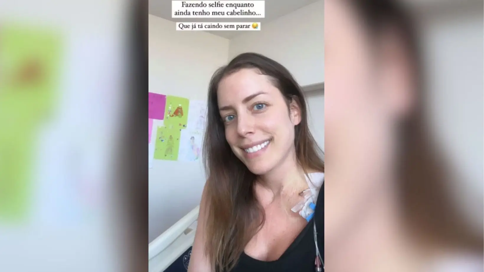 Imagem da notícia: Após diagnóstico de leucemia, Fabiana Justus diz que cabelos já estão caindo